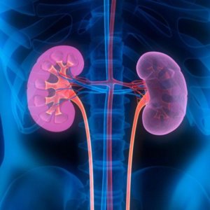 kidney treatment 