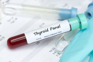 thyroid gland testing 